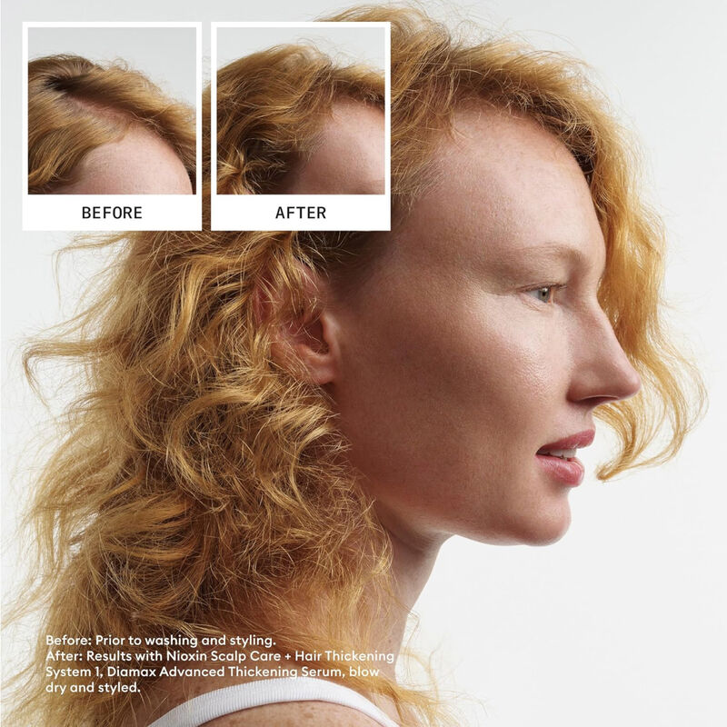 NIOXIN System 1 Scalp Therapy image number 1