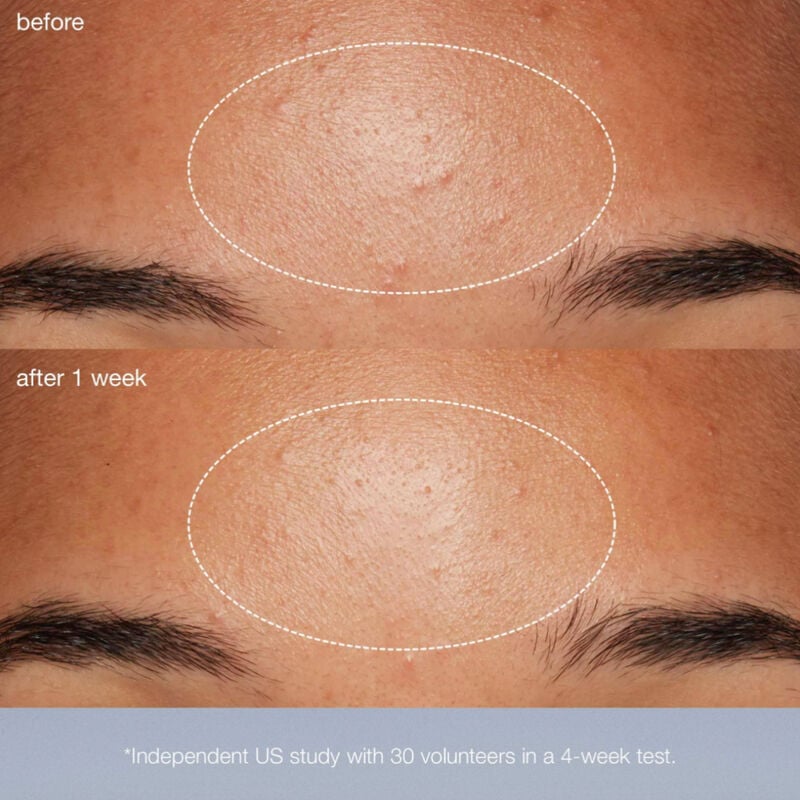 Dermalogica Daily Microfoliant image number 2