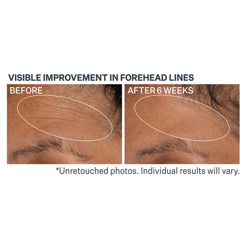 StriVectin Advanced Retinol Daily Repair Moisturizer SPF 30 image number 3