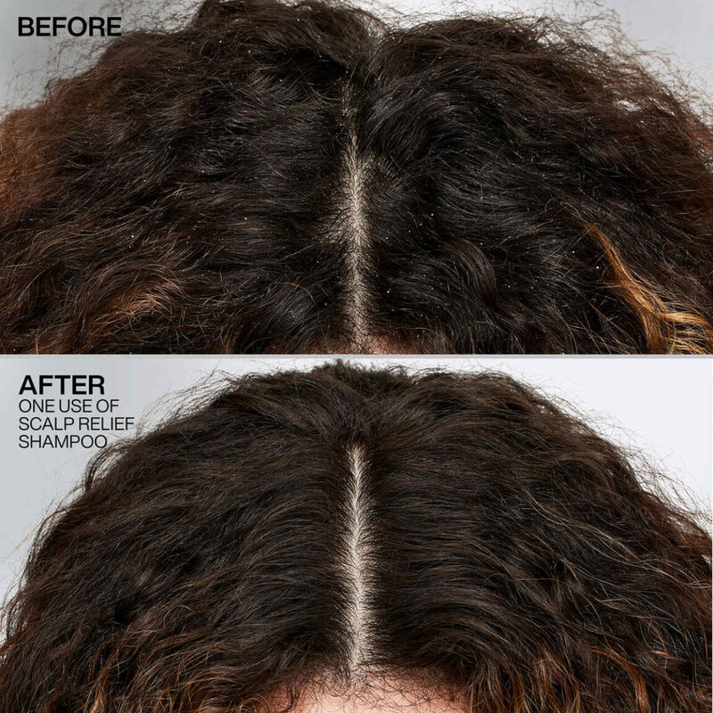 Redken Scalp Relief Dandruff Control Shampoo image number 1