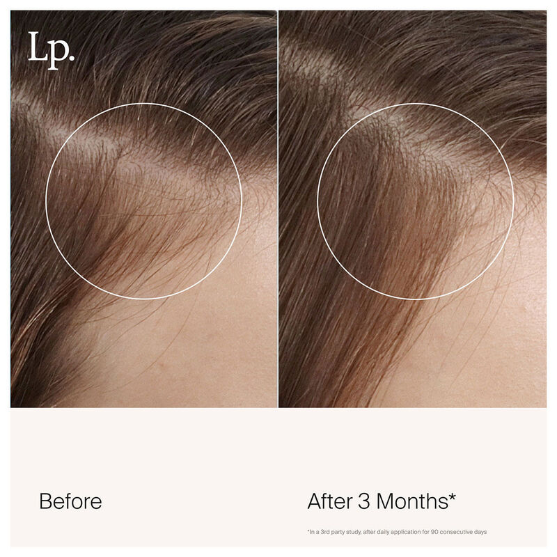 Living Proof Scalp Care Revitalizing Treatment image number 6