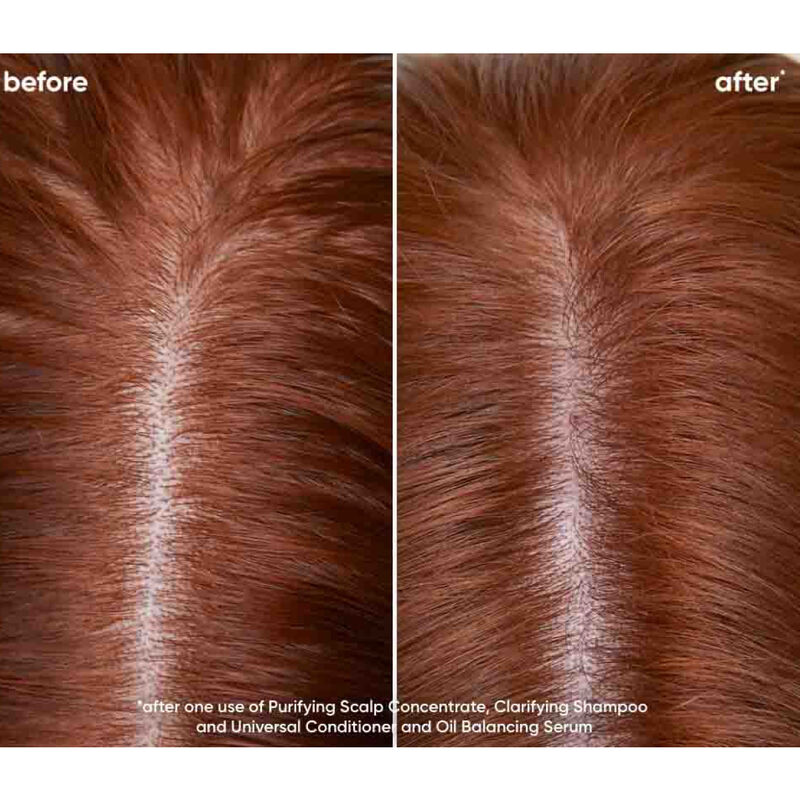 Biolage Scalp Sync Clarifying Shampoo image number 1