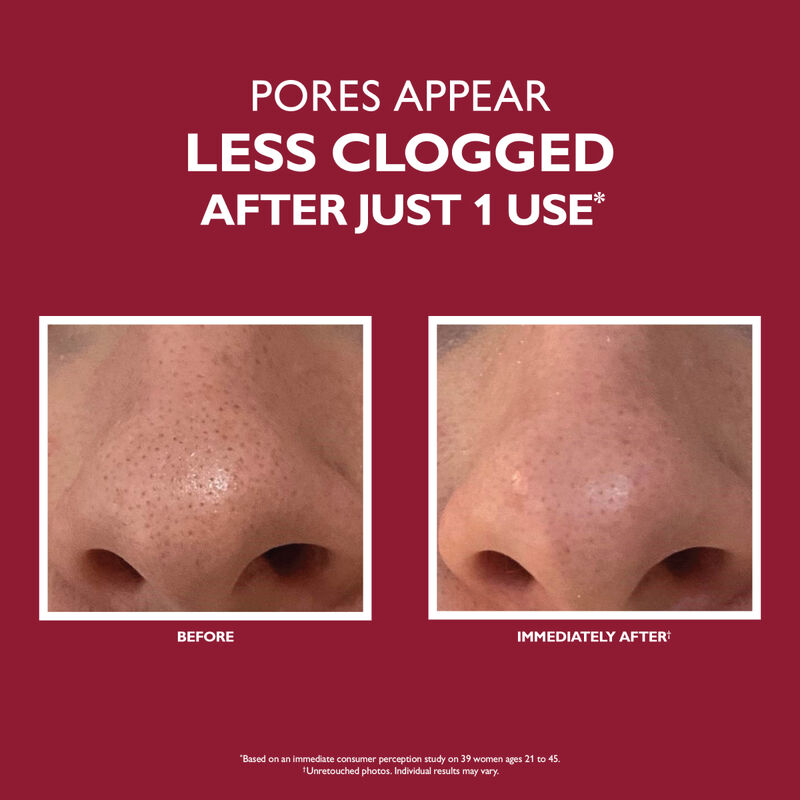 Peter Thomas Roth Even Smoother  Microdermabrasion Exfoliating Pore Treatment image number 1