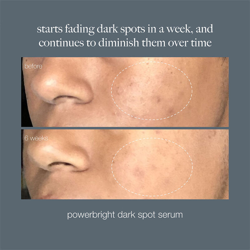 Dermalogica PowerBright Dark Spot Serum image number 1