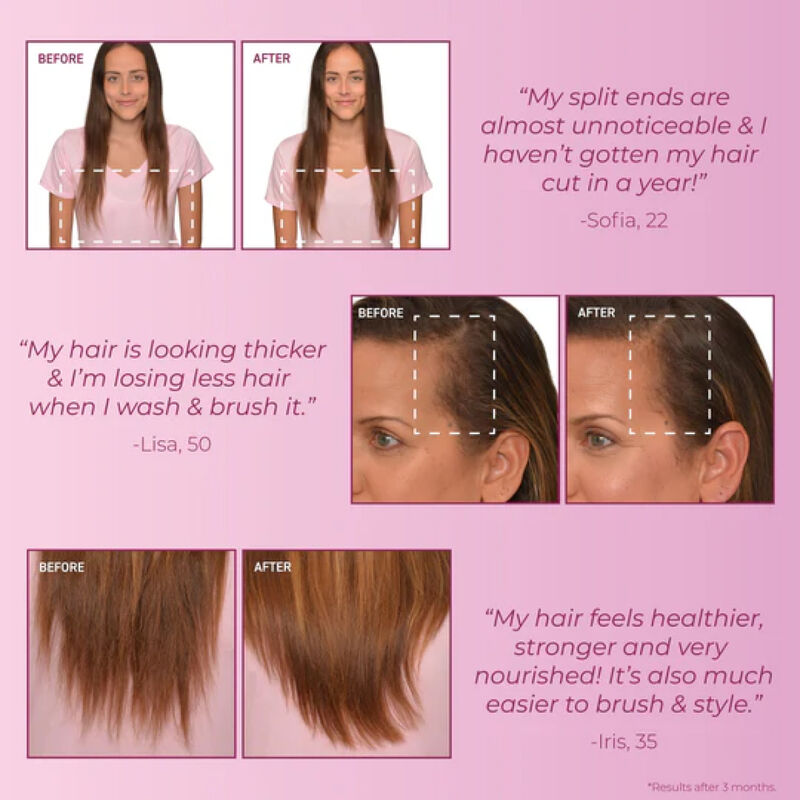Bosley MendxTend Leave In Treatment image number 5