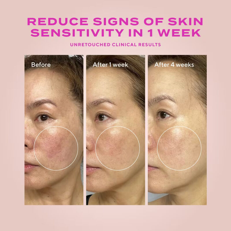 Murad Heartleaf Gentle Resurfacing Serum image number 1