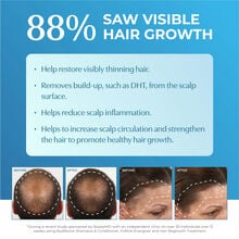 Bosley Men's Extra Strength Minoxidil 5% Topical (Foam)