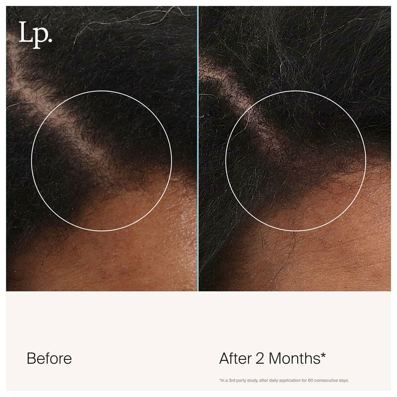 Living Proof Scalp Care Revitalizing Treatment image number 5
