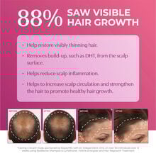 Bosley Women's Extra Strength Minoxidil 5% Topical (Foam)