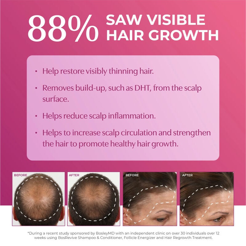 Bosley Women's Extra Strength Minoxidil 5% Topical (Foam) image number 1