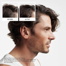 NIOXIN System 2 Scalp Therapy