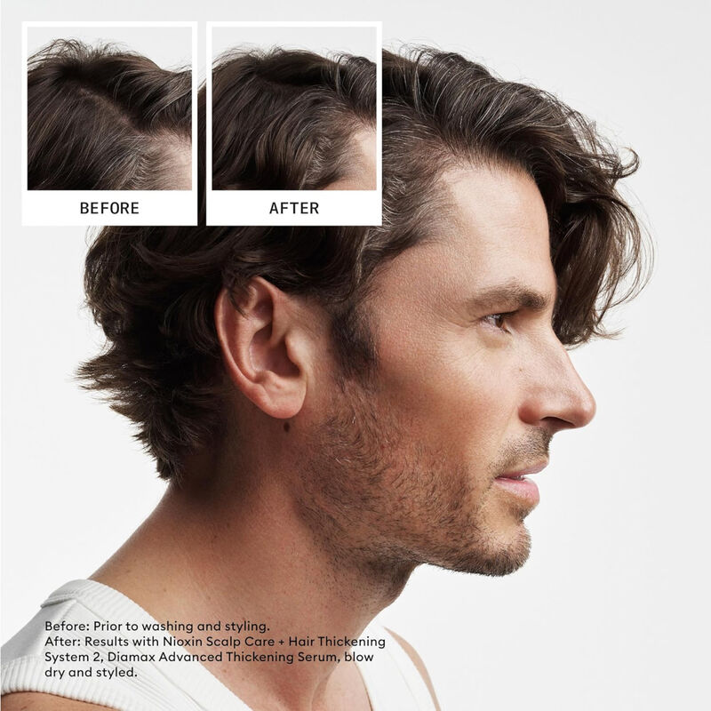 NIOXIN System 2 Scalp Therapy image number 1