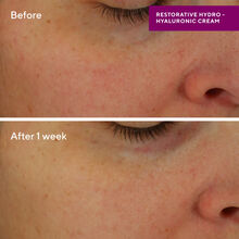 Murad Restorative Hydro Hyaluronic Cream
