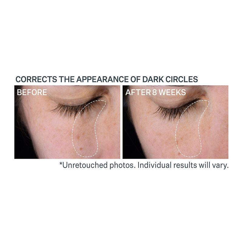 StriVectin Super-C Dark Circle Brightening Serum image number 2
