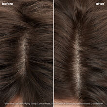 Biolage Scalp Sync Universal Conditioner