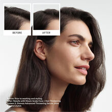 NIOXIN System 3 Scalp Treatment