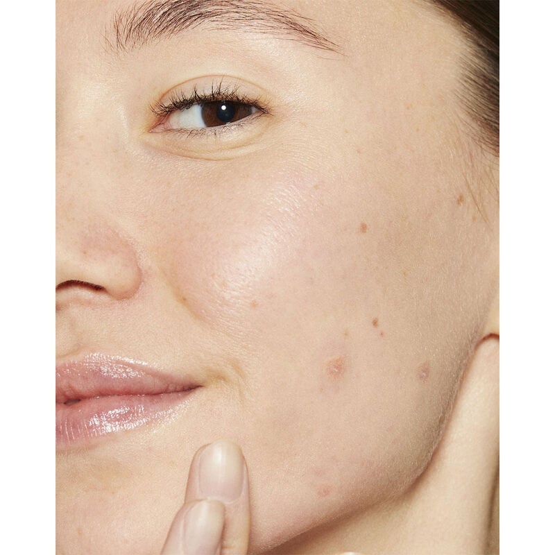 Dermalogica Deep Acne Liquid Patch image number 2