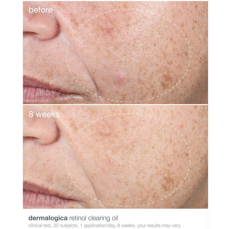 Dermalogica Retinol Acne Clearing Oil image number 1