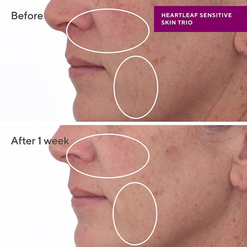 Murad Heartleaf Calming Cream image number 1