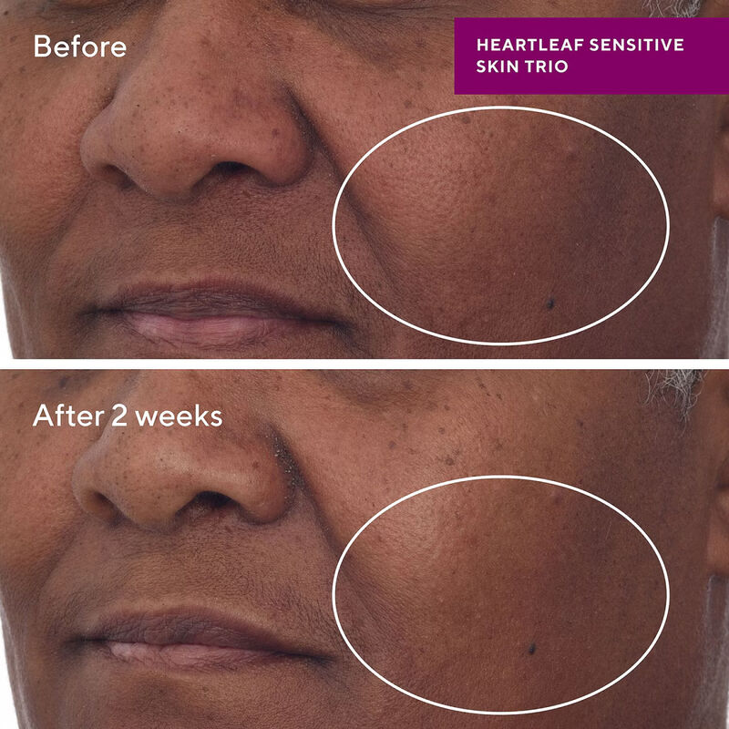 Murad Heartleaf Calming Cream image number 2