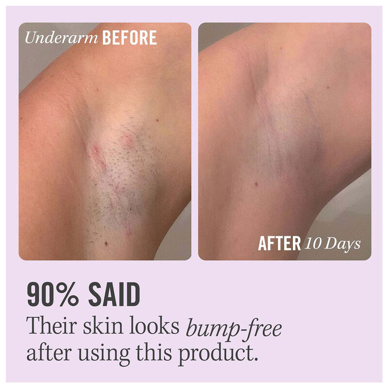 First Aid Beauty Ingrown Hair Pads 28 ct image number 1