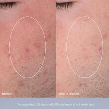 Dermalogica Daily Microfoliant