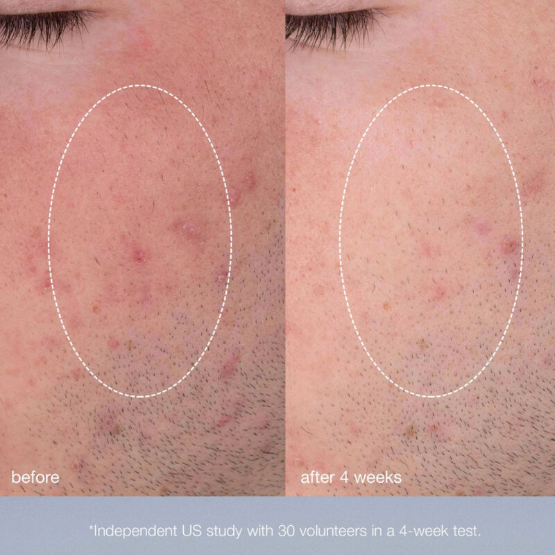 Dermalogica Daily Microfoliant image number 1