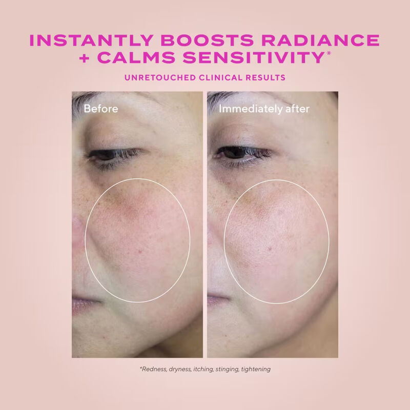 Murad Heartleaf Gentle Resurfacing Serum image number 2