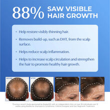 Bosley BosRevive Non Color-Treated Hair 30-Day Kit
