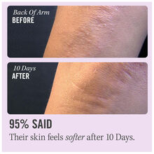 First Aid Beauty KP Bump Eraser Body Scrub With 10% AHA