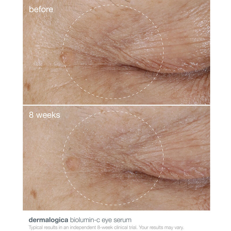 Dermalogica Biolumin-C Eye Serum image number 2