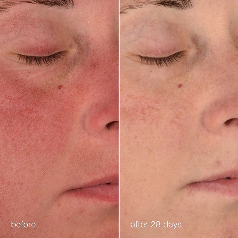 Dermalogica Stabilizing Repair Cream image number 4