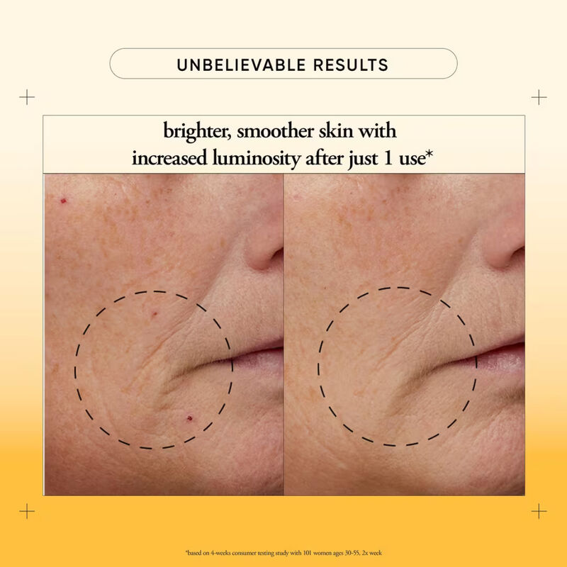 philosophy Microdelivery Two-Step Resurfacing Peel image number 2