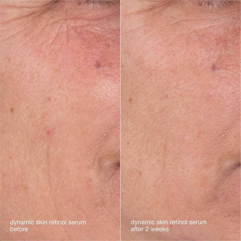 Dermalogica Skin Aging Solutions Skincare Kit image number 3