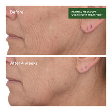 Murad Retinal ReSculpt Overnight Treatment