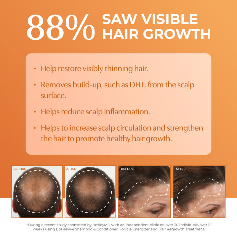 Bosley Revive Color Safe Thickening Treatment image number 1