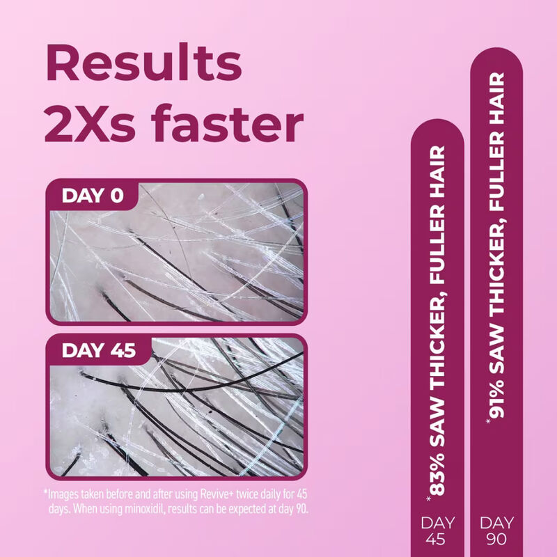 Bosley Women's REVIVE+ Densifying Foam (2 Month Supply) image number 1
