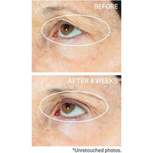 StriVectin Peptight  360  Tightening Eye Serum