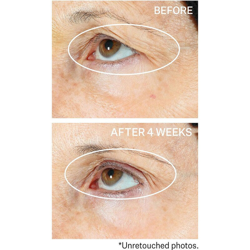 StriVectin Peptight  360  Tightening Eye Serum image number 1