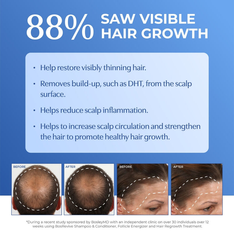 Bosley Revive Thickening Treatment for Non Color-Treated Hair image number 2