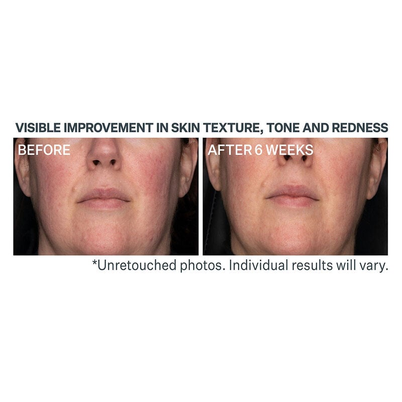 StriVectin Advanced Retinol Daily Repair Moisturizer SPF 30 image number 2