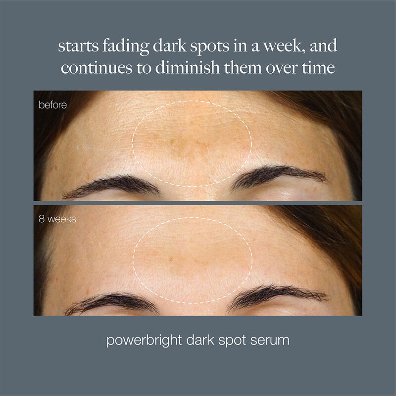Dermalogica PowerBright Dark Spot Serum image number 2