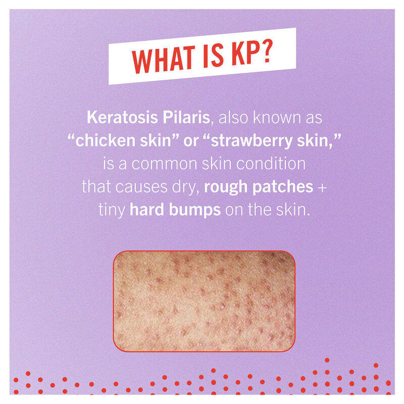First Aid Beauty KP Bump Eraser Body Scrub With 10% AHA image number 2