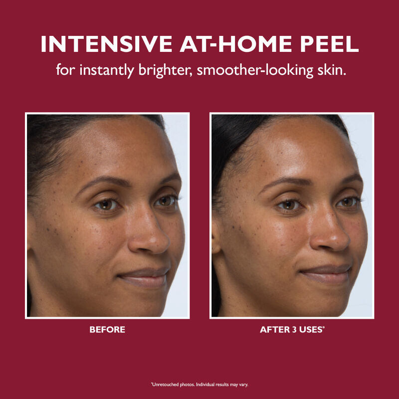 Peter Thomas Roth Even Smoother  Instant Reveal Facial Peel image number 1
