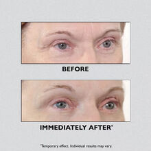 Peter Thomas Roth Instant FIRMx Eye